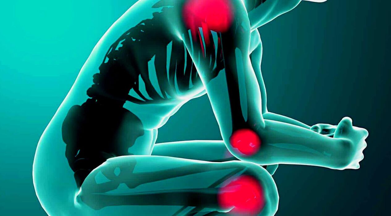 Joint pain, treated with Hondrolife