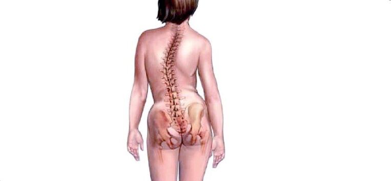 Osteochondral disease