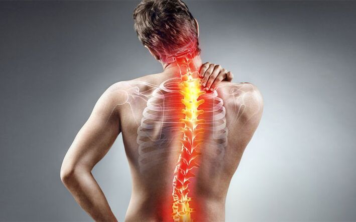 Back pain in scoliosis