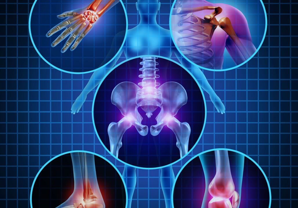 Joints that may be affected by arthrosis