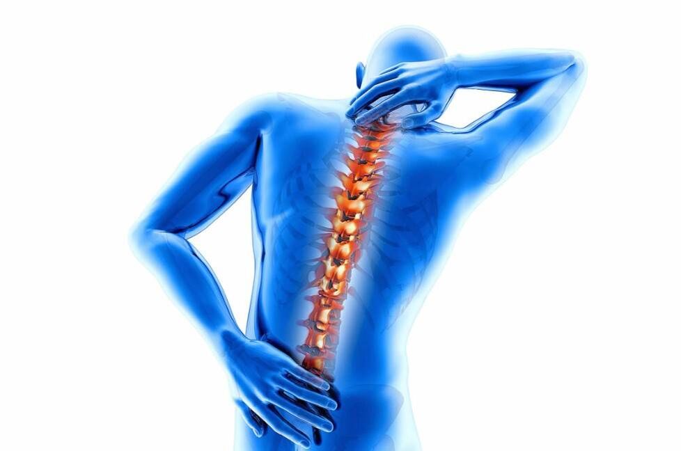 Osteochondrosis with thinning of the intervertebral discs